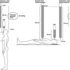 Ocular perfusion pressure (OPP) ( (5) Ocular perfusion pressure (OPP) (5)