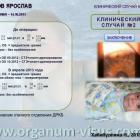 Хабибуллина Наиля Мухаметовна (ДРКБ, г. Казань) Преимущества спонч-дренирования при лечении врожденной глаукомы. Доклад на Всероссийском конгрессе «Глаукома на рубеже веков» 5-6 сентября 2013г., г. Казань, Республика Татарстан, Россия. Информационный партнер www.organum-visus.com Хабибуллина Наиля Мухаметовна (ДРКБ, г. Казань) Преимущества спонч-дренирования при лечении врожденной глаукомы. Доклад на Всероссийском конгрессе «Глаукома на рубеже веков» 5-6 сентября 2013г., г. Казань, Республика Татарстан, Россия. Информационный партнер www.organum-visus.com