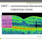 Гасанова З.Э. ОКТ: вчера, сегодня, а что завтра? (Diseases of the Retina) Доклад на Круглом столе «Диагностика глазного дна - State of the Art 2015» (г. Москва, Россия, 15 июня). Совместный Образовательный проект Офтальмоцентра Др. Дашевского и портала Орган зрения www.organum-visus.com (Рис. 10)