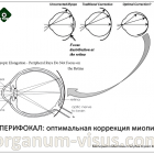 ПЕРИФОКАЛ (PERIFOCAL): об оптимальном способе лечения миопии у детей. Новости офтальмологии портала Орган зрения www.organum-visus.com ПЕРИФОКАЛ (PERIFOCAL): об оптимальном способе лечения миопии у детей. Новости офтальмологии портала Орган зрения www.organum-visus.com