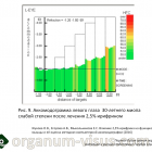 Жукова О.В., Егорова А.В., Мыкольникова Е.С. Влияние 2,5% ирифрина на функцию цилиарной мышцы и её оценка методом компьютерной аккомодографии. Новости офтальмологии портала Орган зрения organum-visus.com Жукова О.В., Егорова А.В., Мыкольникова Е.С. Влияние 2,5% ирифрина на функцию цилиарной мышцы и её оценка методом компьютерной аккомодографии. Новости офтальмологии портала Орган зрения organum-visus.ru