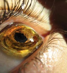 Капля зрения. About eyes everywhere! www.organum-visus.com Капля зрения. About eyes everywhere! www.organum-visus.com