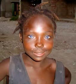 Черная кожа, голубые глаза. Черная кожа, голубые глаза.