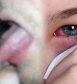 Результат любви к глазу. Eyeball licking! О глазах отовсюду на портале Орган зрения www.organum-visus.com Результат любви к глазу. Eyeball licking! О глазах отовсюду на портале Орган зрения www.organum-visus.com